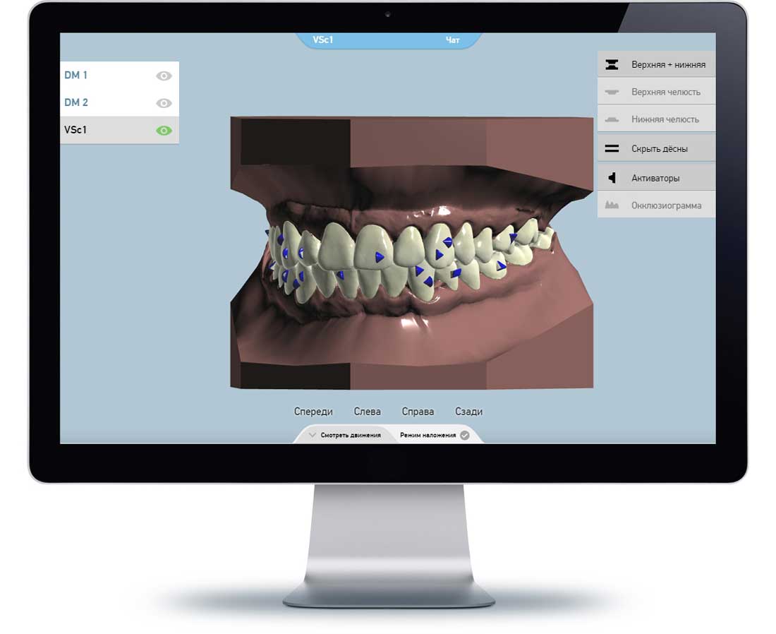 3d моделирование star smile