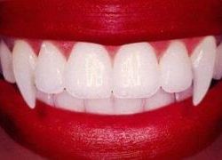 Новые тенденции в стоматологической эстетике