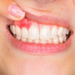 5 фактов о ваших зубах, про которые вы не знали