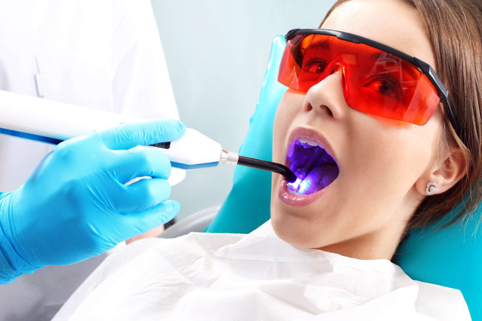 Лазерное десен. Лазерная стоматология. Лазерное отбеливание зубов. Стоматологический лазер. Отбеливание зубов в стоматологии.