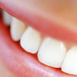 10 способов разрушить ваши зубы
