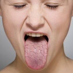 Сухость во рту — причины и что это значит